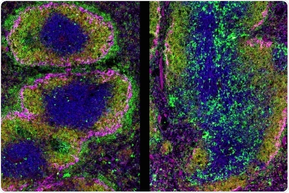 Scientists show how protein Ikaros orchestrates fine balance to control autoimmunity