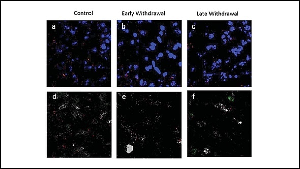 Diabetes drug abolishes characteristic signs of nicotine withdrawal in mice