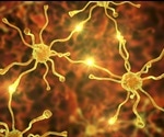 TDP-43 study could speed up the diagnosis and treatment of ALS