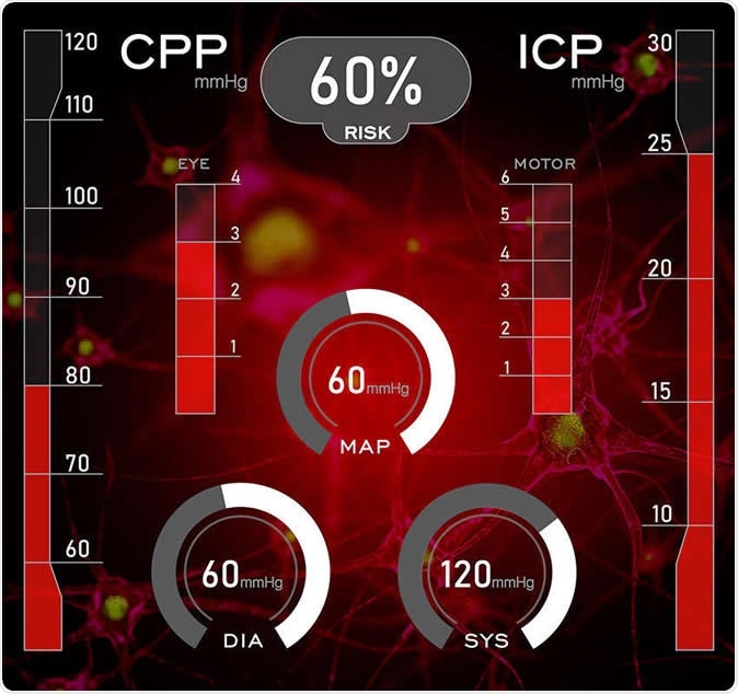 An artist’s illustration of modern neurosurgical intensive care and the use of machine learning algorithms. Credit: Rahul Raj, University of Helsinki