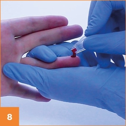 Step 8 in taking a blood prick