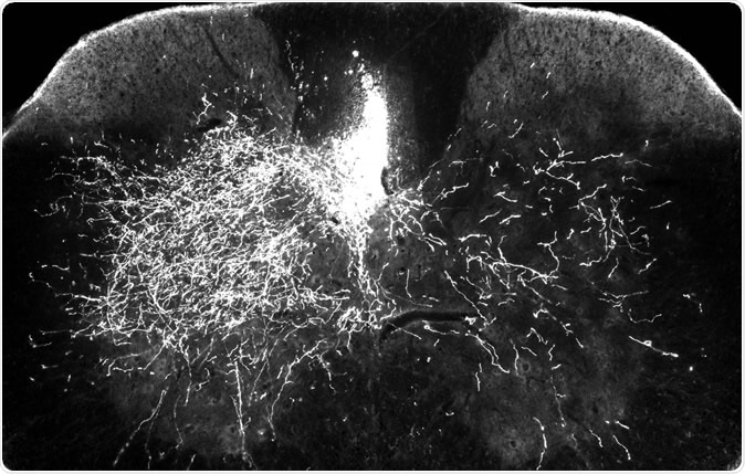 In one of the mouse models for this research, one side of the descending spinal pathway is damaged (above right) while the other side (above left) remains intact. In this image, bright streaks on the right show that in mice treated with gabapentin, descending motor axons are able to sprout to send nerve impulses to the denervated part of the spinal cord – a key step in rebuilding the central nervous system after injury.