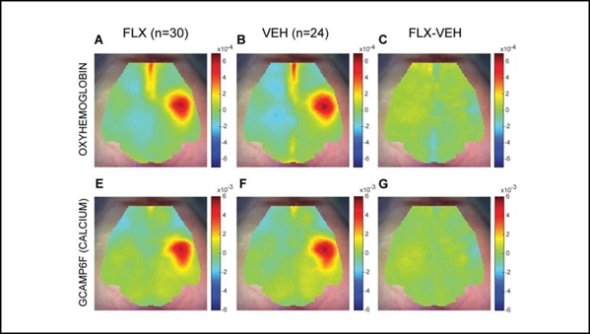Mice study shows the impact of taking antidepressants during pregnancy