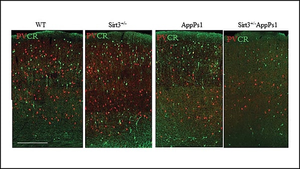 Ketone-supplemented diet may help fight against Alzheimer’s disease