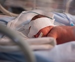 New methodologies could help premature babies breathe easy