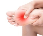 What is Small Fiber Neuropathy?