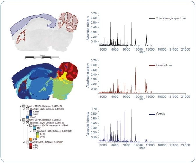 Spatial segmentation of intact protein MALDI imaging data acquired from a sagittal mouse brain section. Left-hand side: Optical image overlayed with 2 distinct regions as obtained from spatial segmentation (top); segmentation map (center); segmentation tree (bottom). Right-hand side: Average spectra representing total measurement region (top), cerebellum (center) and cortex (bottom) as yielded by spatial segmentation