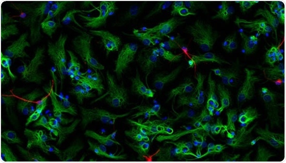 Neural precursor cells form into neurospheres, which then differentiate into astrocytes (green) and new neurons (red).