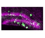 Single lineage of stem cells contributes to lifelong hippocampal neurogenesis in mice