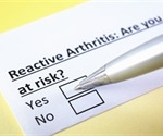 Treating and Managing Reactive Arthritis (ReA)