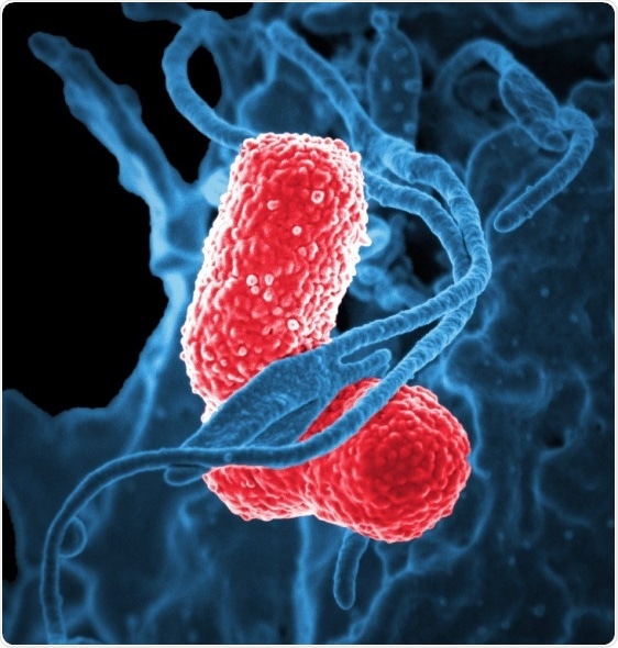Human contact plays major role in the spread of some hospital-acquired infections