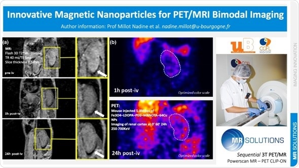 Innovative magnetic nanoparticles show potential for PET/MRI bimodal imaging applications