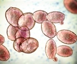 Candida yeast infections more common in men with schizophrenia or bipolar disorder