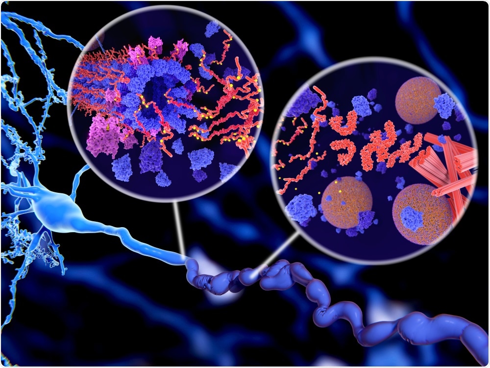Prions have now been linked to tau tangles and amyloid plaques seen in alzheimer