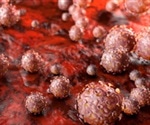 HPV Vaccination and Autoimmune Disorders: Is There a Link?