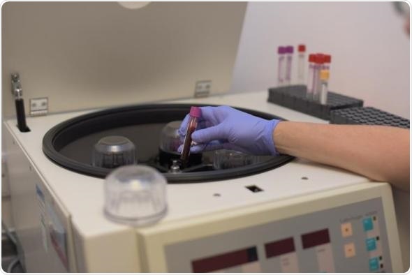 Blood stem cell breakthrough could spare some patients from side effects of cancer treatments