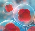 Hidden cell structures reveal a common weakness in leukemia