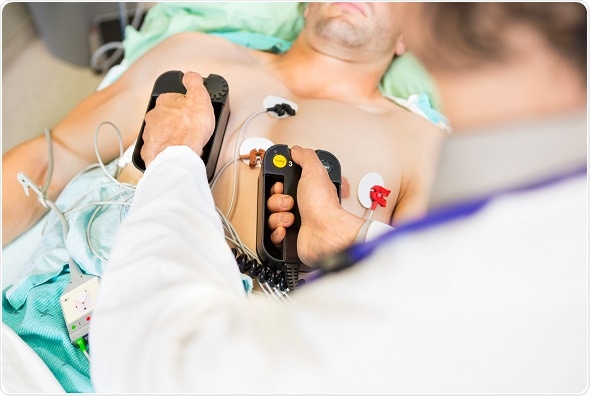 LDL-cholesterol does not predict future cardiovascular events in high-risk heart patients