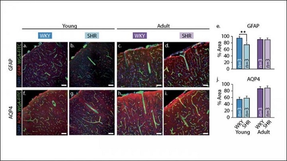 Healthy blood vessels could help stave off cognitive decline