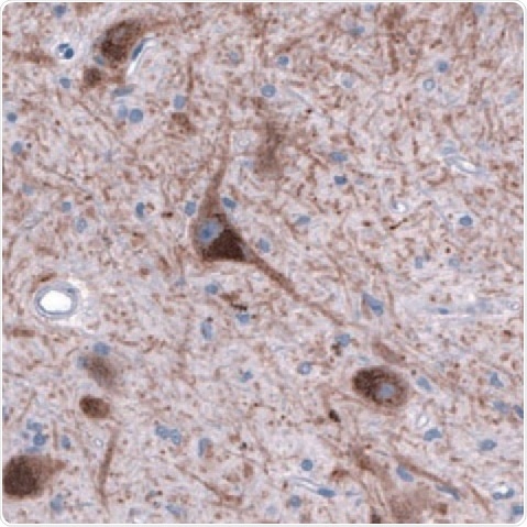 DAT1 in Human Brain.