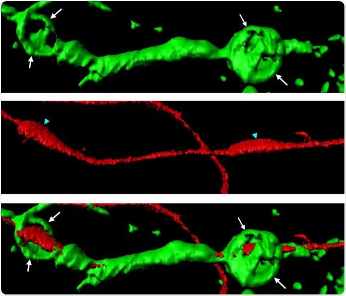 Actin spheres (green) wrapped around a severed axon (red). Image Credit: Adrien Vaquie (Cell Reports)