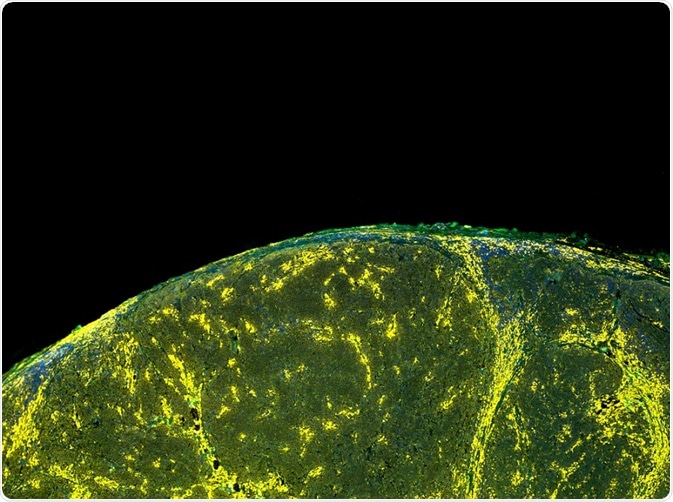 Fluorochromes are used for a number of applications. Here, cell markers have been highlighted with a fluorescent marker (a fluorochrome).