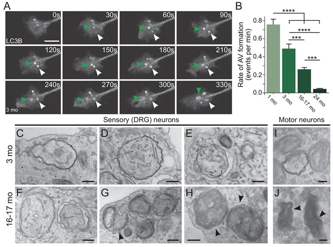 Aberrantly formed autophagosomes accumulate in neuron of an aged mouse (Credit: Andrea Stavoe, Penn Medicine; eLife)