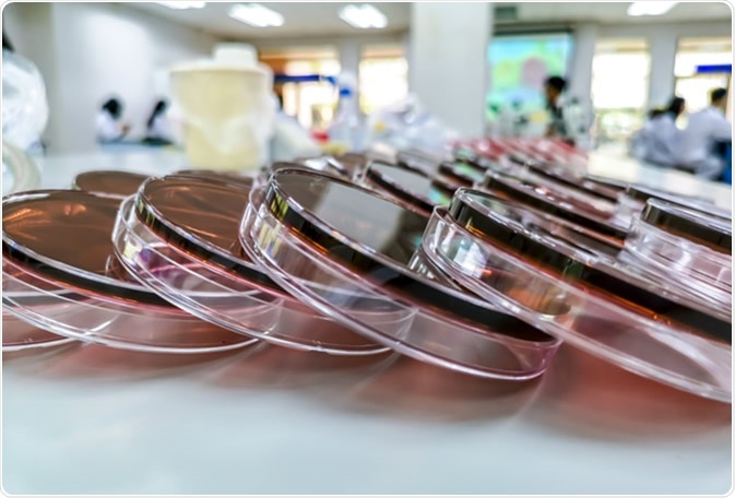 Eosin Methylene Blue (EMB) Agar. Image Credit: OneMashi / Shutterstock