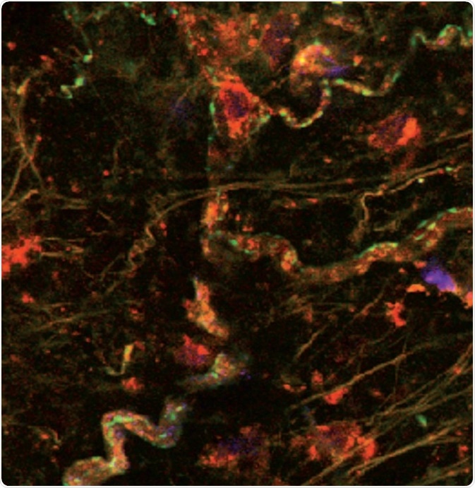 Fluorescent ligand binding in the perivascular nerve. Fluorescent ligand, Tocrifluor T1117 (Cat. No. 2540), shows GPR55 receptor (red/orange) expression in perivascular nerve cells and blood vessels, additional staining illustrates expression of α1‑adrenoceptors (green). Image kindly provided by Dr Craig Daly, University of Glasgow (see Daly et al (2010), for further reference).