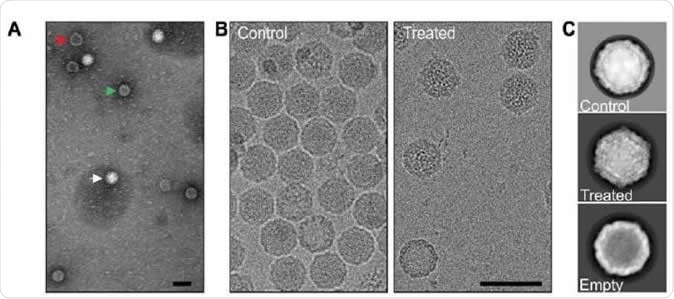 These are enteroviruses in electron microscope. Albumin helps enteroviruses to open. Image Credit: University of Helsinki and University of Jyväskyla/Visa Ruokolainen and Ausra Domaska