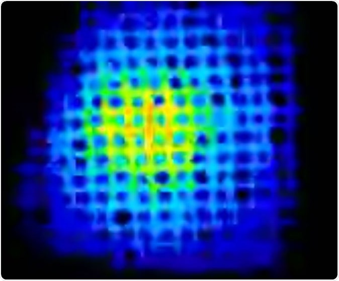 Ultrasensitive Sniff-Cam for Biofluorometric-Imaging of Breath Ethanol Caused by Metabolism of Intestinal Flora