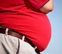 New medical database enhances obesity research and treatment