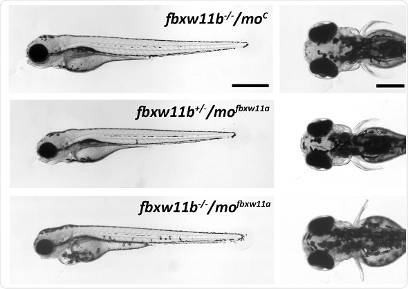 Research team discovers gene critical for human eye, brain and limb development Research team discovers gene critical for human eye, brain and limb development