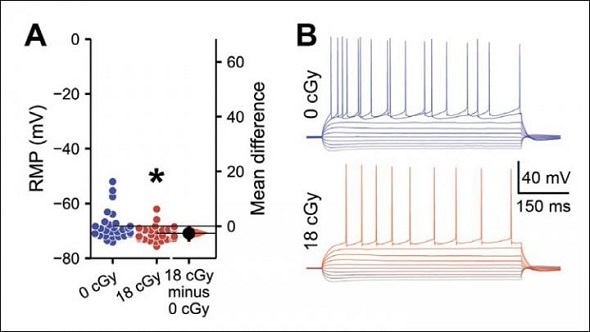Researchers investigate how deep space travel could affect the brain