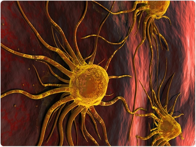 Breast Cancer Cells. Image Credit: Ancroft / Shutterstock