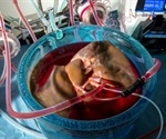 Supercooling helps preserve human transplant organs longer