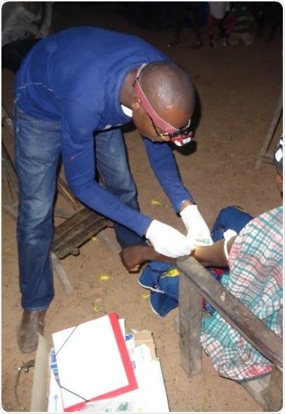 Molecular changes are linked with adverse events following treatment of lymphatic filariasis