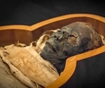 Mummies show atherosclerosis was prevalent in ancient times