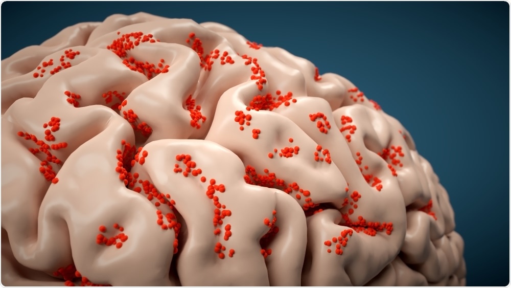 Eastern Equine Encephalitis (EEE) virus attacking brain