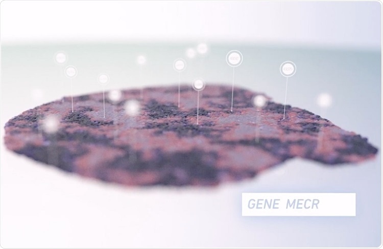 Spatial gene expression profiling