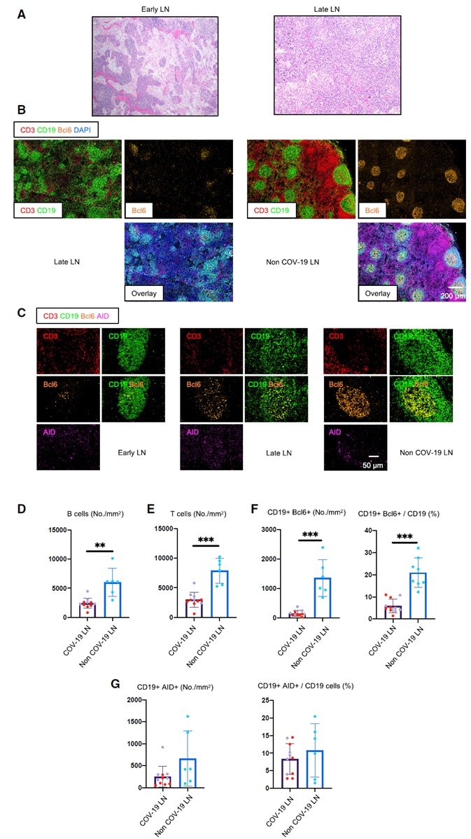 Early Loss of Germinal Centers and Bcl-6-Expressing B Cells in COVID-19 Thoracic Lymph Nodes.