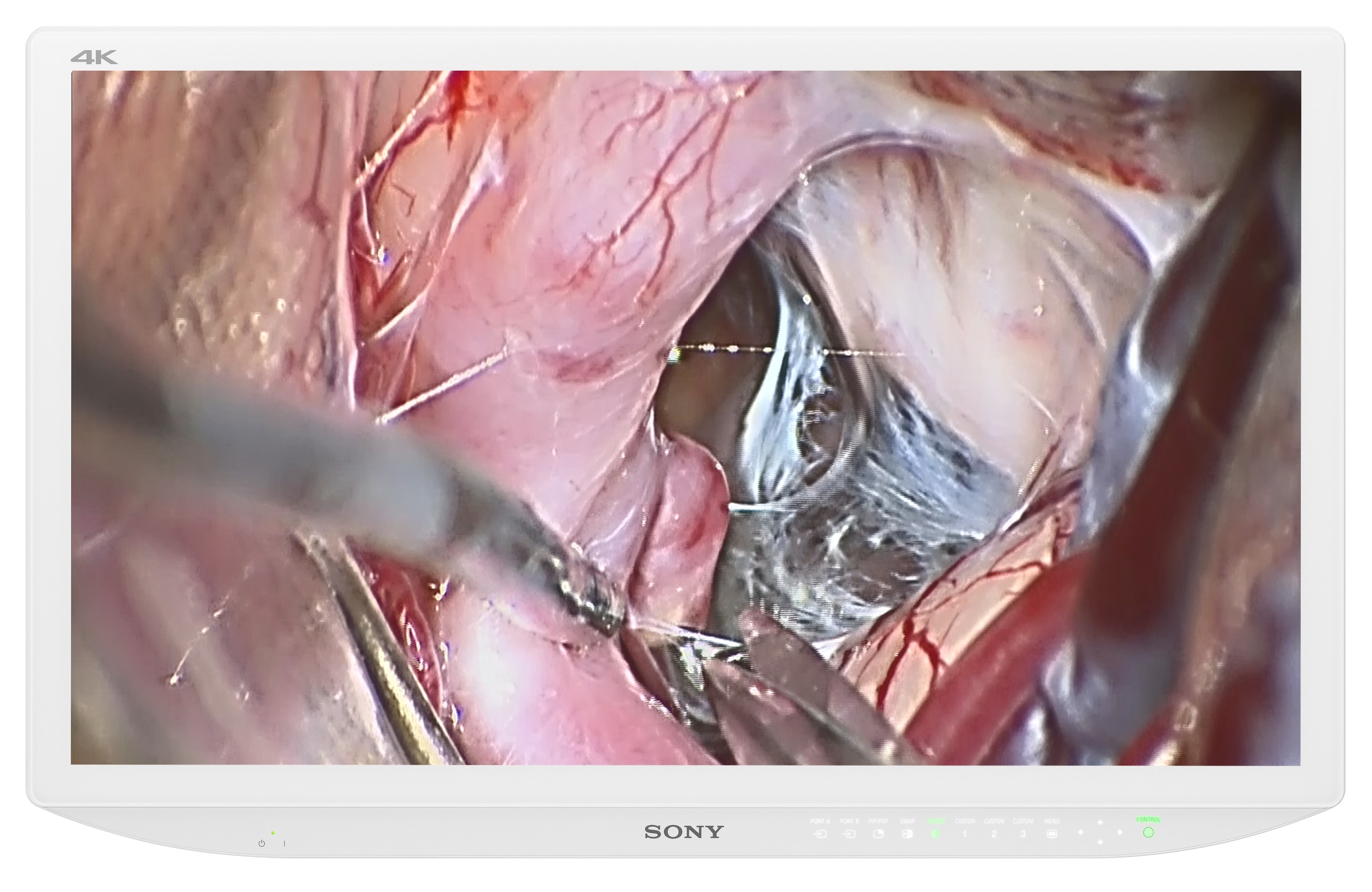 Sony introduces new LMD-X3200MD medical grade LCD monitor