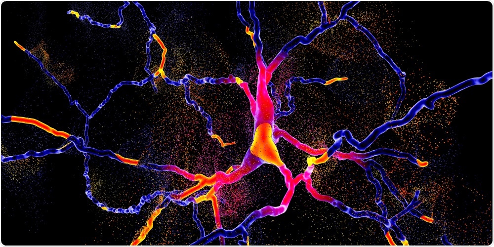 Degeneration of dopaminergic neuron