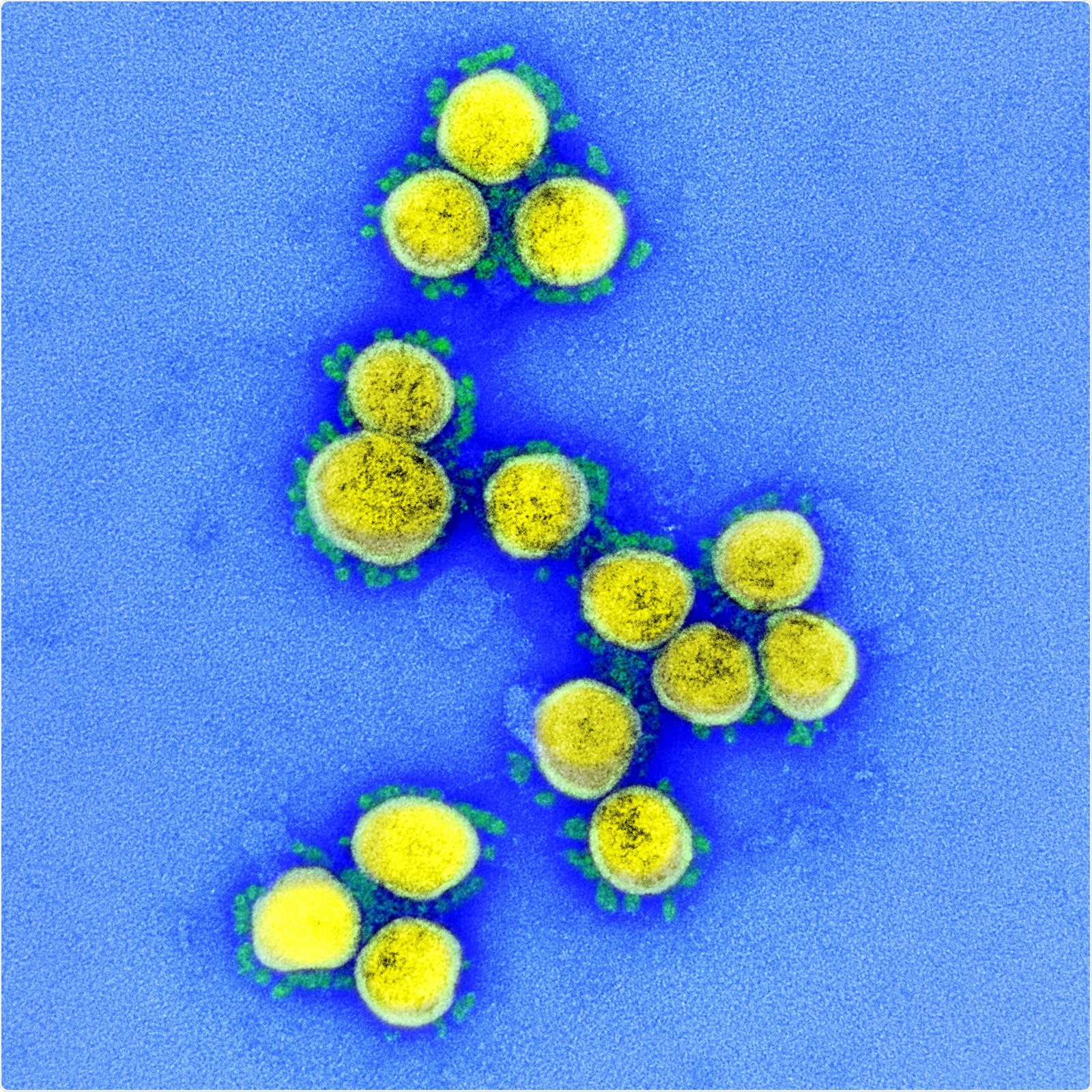 Study: The Progression of SARS Coronavirus 2 (SARS-CoV-2). Image Credit: NAID / Flickr.