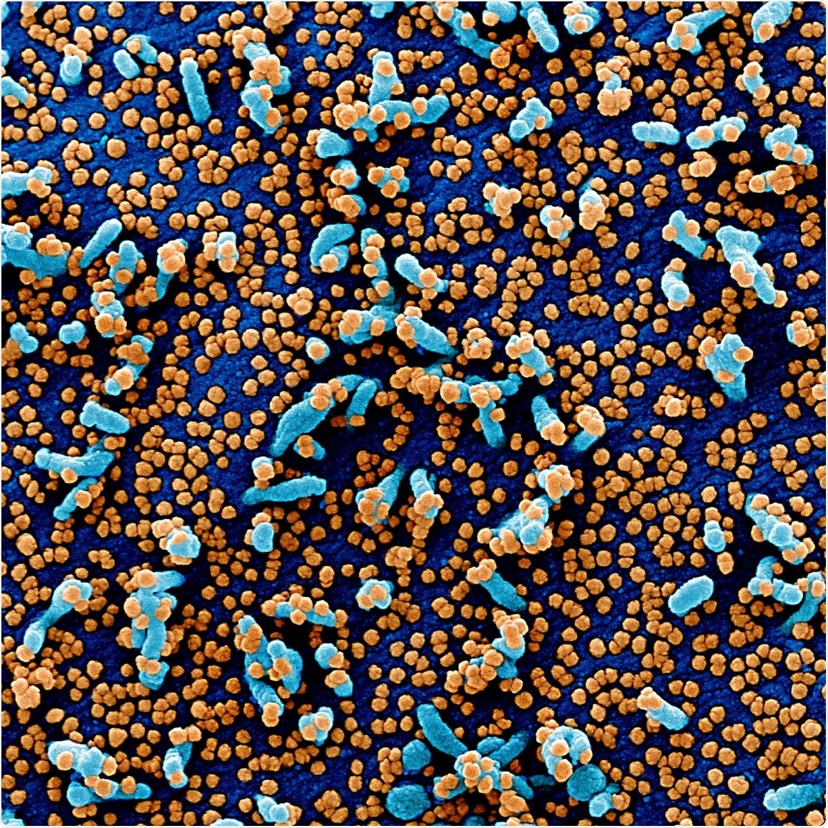 Study: COVID-19 re-infection: prolonged shedding or true reinfection. Image Credit: NIAID / Flickr