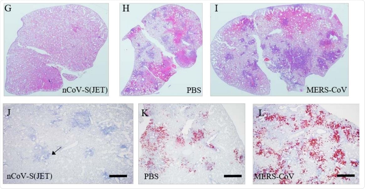 G) nCoV-S(JET) DNA, H) PBS, or I) MERS-CoV vaccinated hamsters where purple indicates areas of consolidation. ISH to detect SARS-CoV-2 genomic RNA in lung sections of J) nCoV-S(JET) DNA, K) PBS, and L) MERSCoV vaccinated hamsters. Rare, positive labeling in nCoV-S(JET) DNA vaccinated hamster lung sections were detected (arrows). Asterisks indicate that results were statistically significant, as follows: *, P<0.05; **, P<0.01; ***, P<0.001; ns, not significant. Scale bars = 400 microns.
