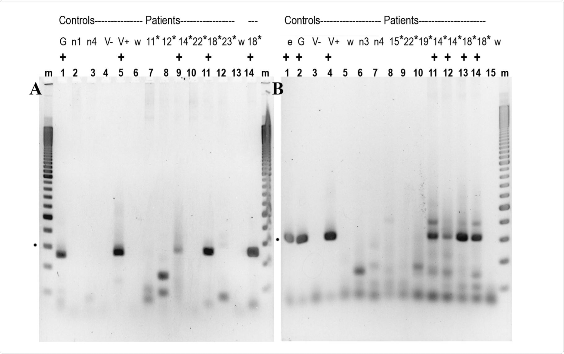 A 2.5% agarose gel showing RT/qPCR products