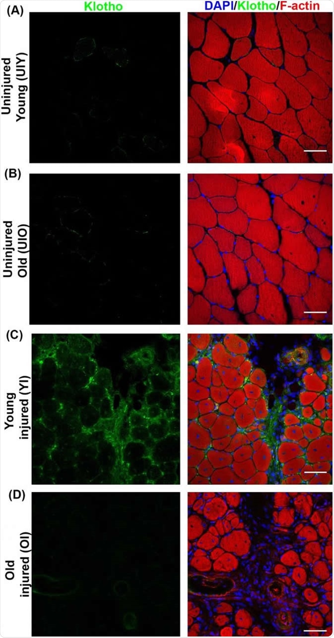 Klotho (green) is expressed around an injury site in muscle tissue (red) in young mice. CREDIT Sahu et al. (2018), Nature Communications