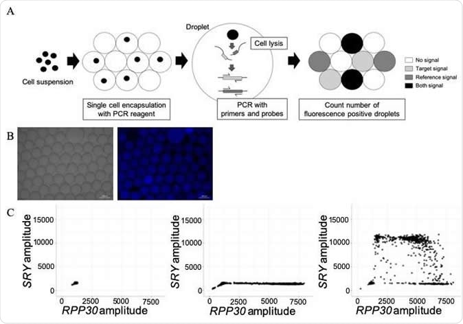 A) Schema of the single-cell-based droplet digital PCR (sc-ddPCR) system. Using the QX200 ddPCR system, each cell is simply encapsulated in one droplet. Up to 3,000 cells per well can be individually encapsulated. Subsequently, cell lysis and PCR with probes and primers are performed in each droplet. Finally, by quantifying the fluorescent droplets, single-cell genomic DNA is able to be assessed. B) Confirmation of single-cell encapsulation after generating droplets with a human B-cell line. Left, in bright field; right, with a Hoechst filter. C) Two-dimensional plot of signal amplitude of SRY and RPP30 probes in each droplet detected using our modified sc-ddPCR system. Signal amplitude of probes with 1× PBS as a blank control (left), a human female B-cell line (HEV0230) as a negative control (middle), and a human male B-cell line (HEV0057) as a positive control (right). Credit: Journal of Molecular Diagnostics
