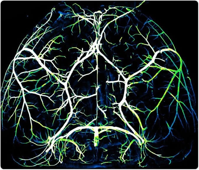 Arteries in the brain. Image Credit: Gu Lab/Harvard Medical School